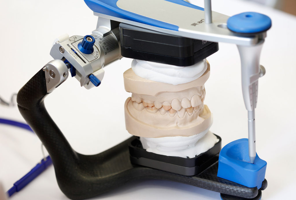 artikulatoren_dentallabor Dentallabor Frank Altmann