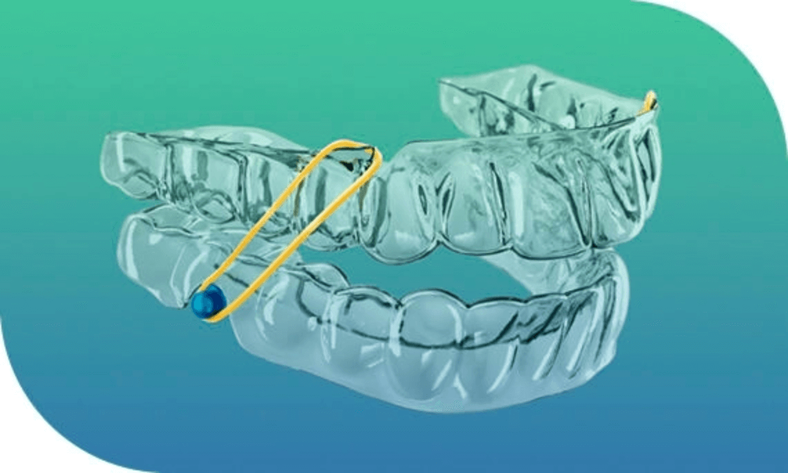 SureSmile 4 - Digital Workflow